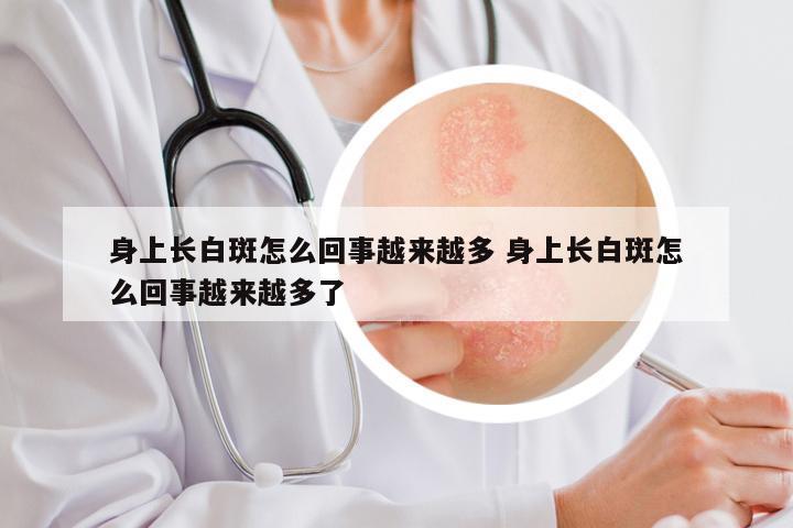 身上长白斑怎么回事越来越多 身上长白斑怎么回事越来越多了