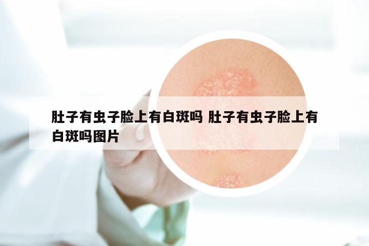 肚子有虫子脸上有白斑吗 肚子有虫子脸上有白斑吗图片