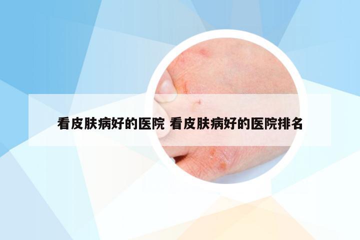 看皮肤病好的医院 看皮肤病好的医院排名