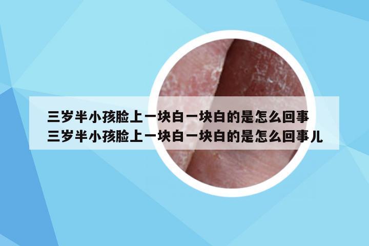 三岁半小孩脸上一块白一块白的是怎么回事 三岁半小孩脸上一块白一块白的是怎么回事儿