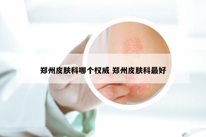 郑州皮肤科哪个权威 郑州皮肤科最好