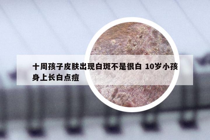 十周孩子皮肤出现白斑不是很白 10岁小孩身上长白点痘