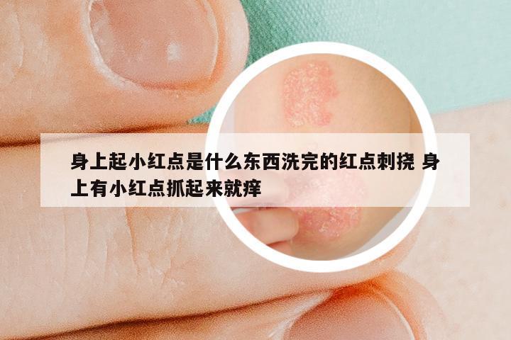身上起小红点是什么东西洗完的红点刺挠 身上有小红点抓起来就痒
