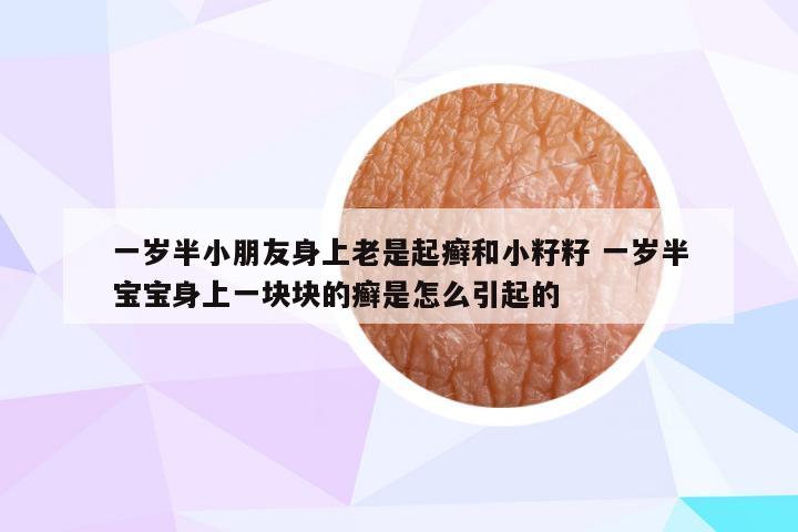 一岁半小朋友身上老是起癣和小籽籽 一岁半宝宝身上一块块的癣是怎么引起的