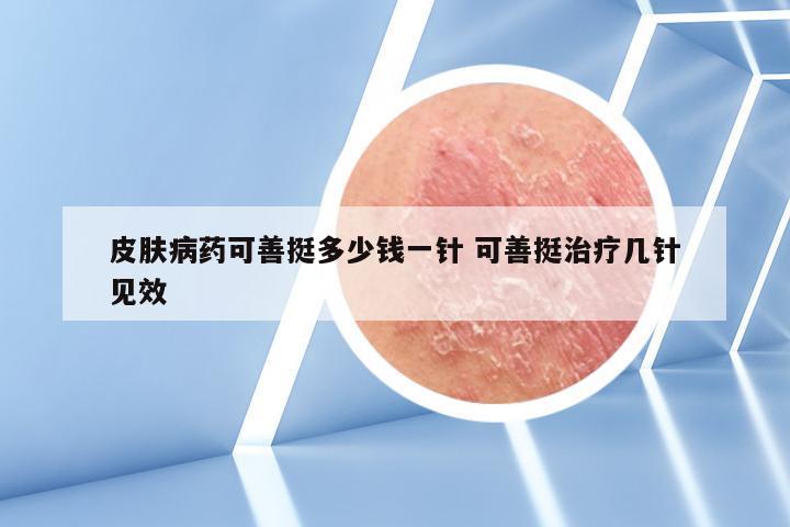 皮肤病药可善挺多少钱一针 可善挺治疗几针见效