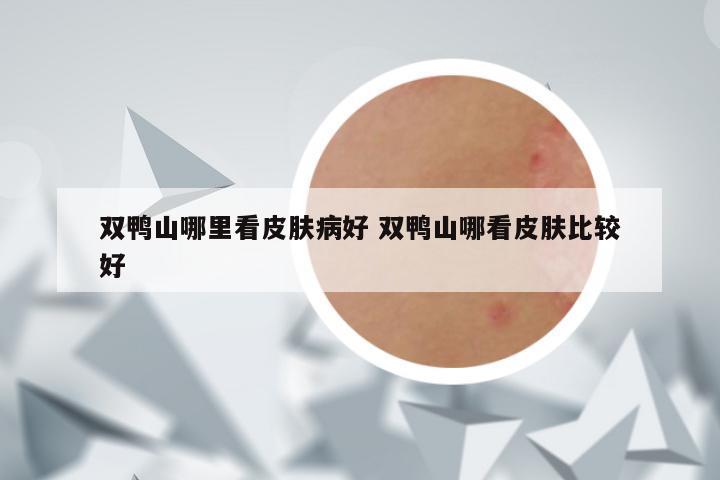双鸭山哪里看皮肤病好 双鸭山哪看皮肤比较好