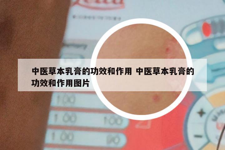 中医草本乳膏的功效和作用 中医草本乳膏的功效和作用图片