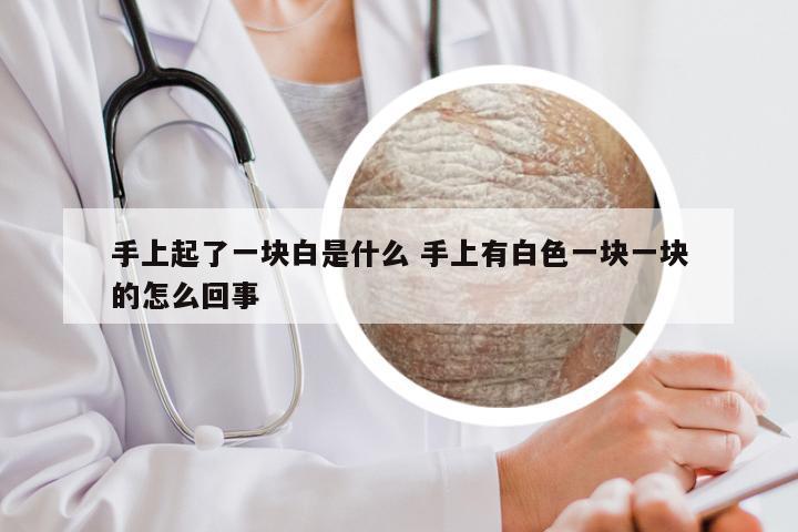 手上起了一块白是什么 手上有白色一块一块的怎么回事