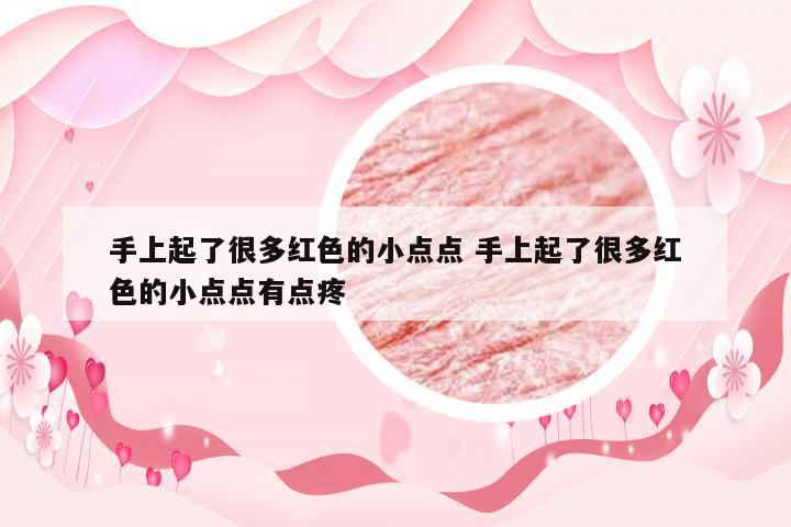 手上起了很多红色的小点点 手上起了很多红色的小点点有点疼