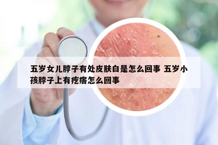 五岁女儿脖子有处皮肤白是怎么回事 五岁小孩脖子上有疙瘩怎么回事