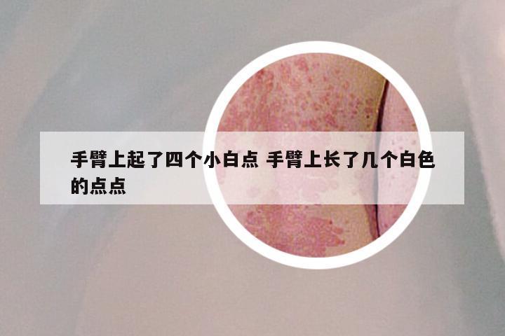 手臂上起了四个小白点 手臂上长了几个白色的点点