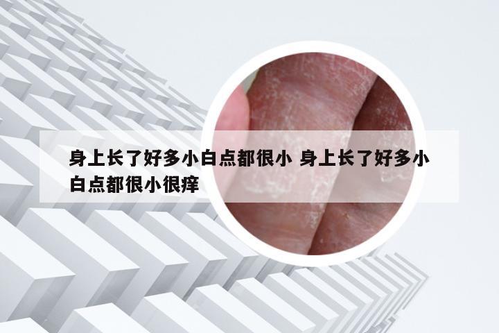 身上长了好多小白点都很小 身上长了好多小白点都很小很痒