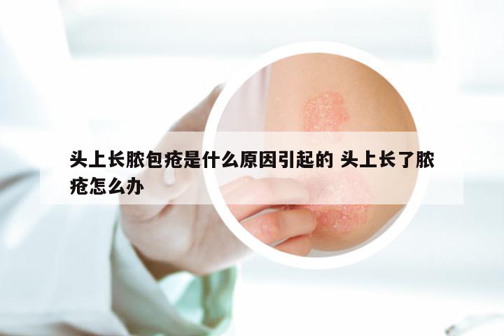 头上长脓包疮是什么原因引起的 头上长了脓疮怎么办