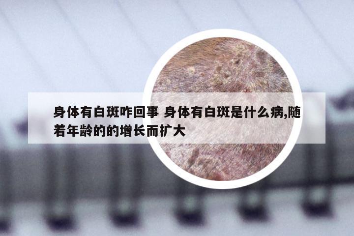 身体有白斑咋回事 身体有白斑是什么病,随着年龄的的增长而扩大