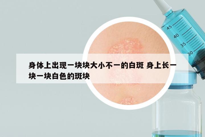 身体上出现一块块大小不一的白斑 身上长一块一块白色的斑块