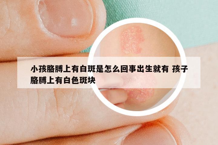 小孩胳膊上有白斑是怎么回事出生就有 孩子胳膊上有白色斑块