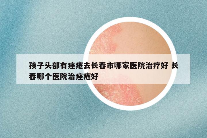 孩子头部有痤疮去长春市哪家医院治疗好 长春哪个医院治痤疮好