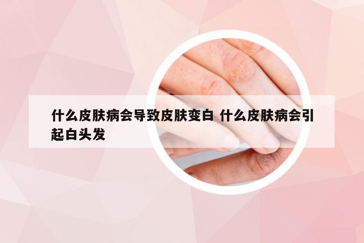 什么皮肤病会导致皮肤变白 什么皮肤病会引起白头发