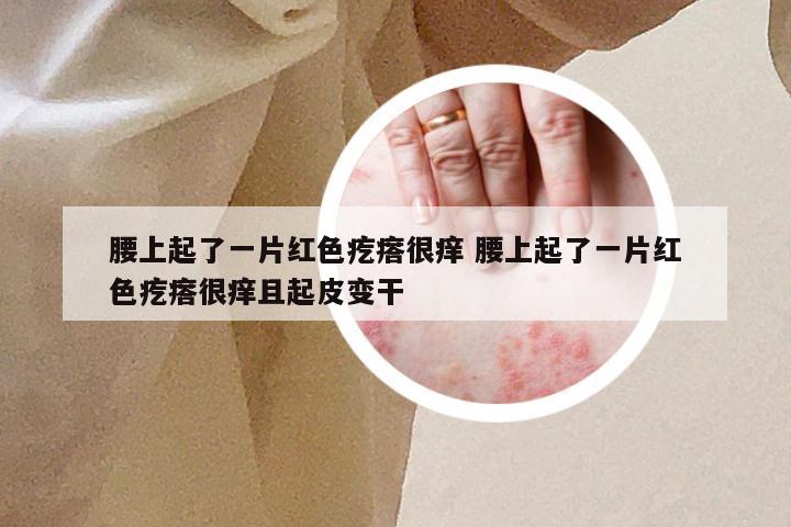 腰上起了一片红色疙瘩很痒 腰上起了一片红色疙瘩很痒且起皮变干