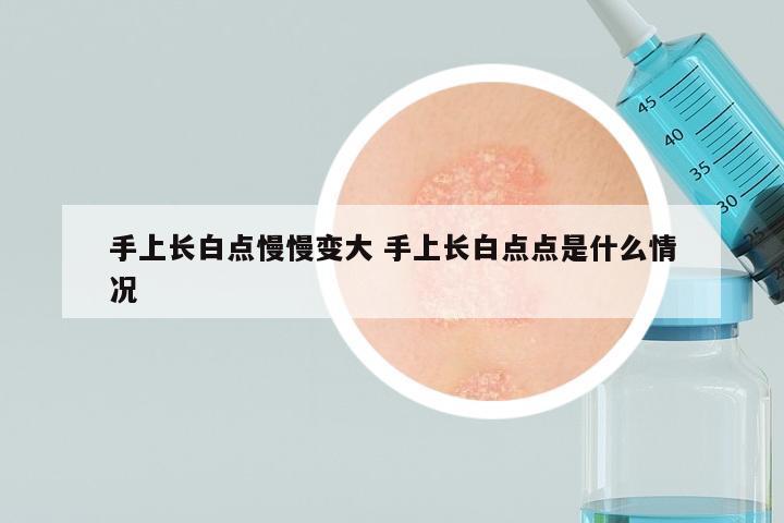 手上长白点慢慢变大 手上长白点点是什么情况