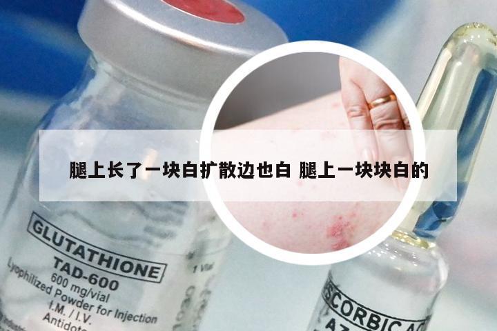 腿上长了一块白扩散边也白 腿上一块块白的