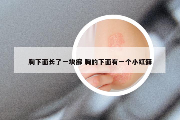胸下面长了一块癣 胸的下面有一个小红藓