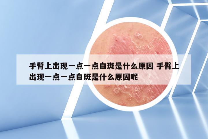 手臂上出现一点一点白斑是什么原因 手臂上出现一点一点白斑是什么原因呢