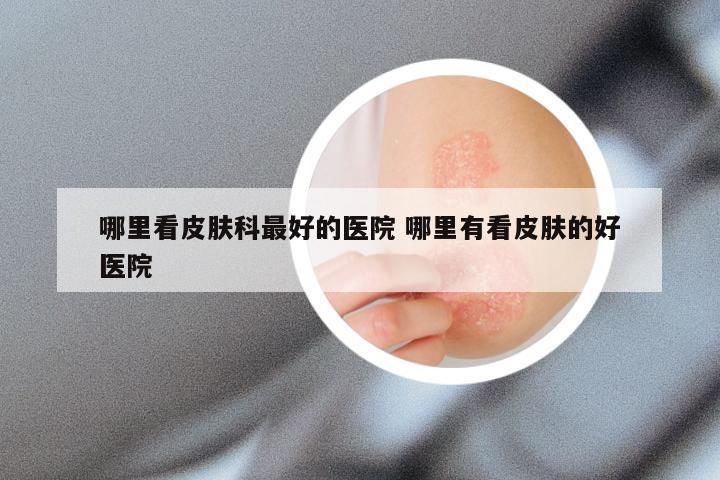 哪里看皮肤科最好的医院 哪里有看皮肤的好医院