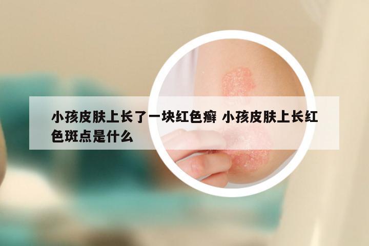 小孩皮肤上长了一块红色癣 小孩皮肤上长红色斑点是什么