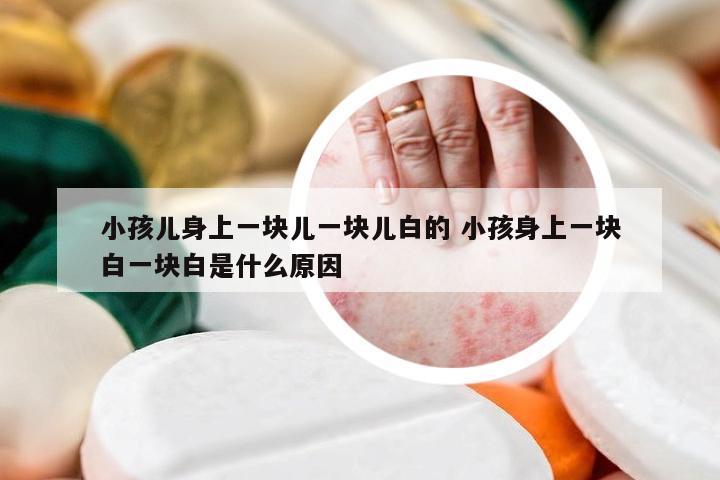 小孩儿身上一块儿一块儿白的 小孩身上一块白一块白是什么原因