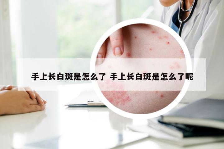 手上长白斑是怎么了 手上长白斑是怎么了呢