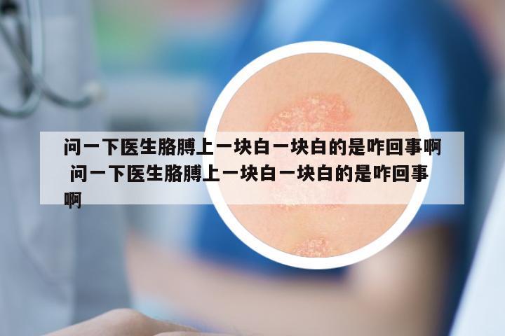 问一下医生胳膊上一块白一块白的是咋回事啊 问一下医生胳膊上一块白一块白的是咋回事啊