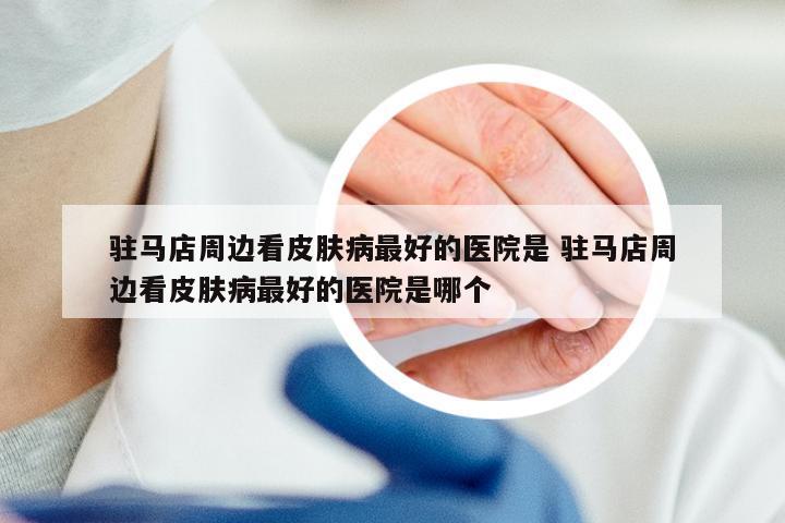 驻马店周边看皮肤病最好的医院是 驻马店周边看皮肤病最好的医院是哪个