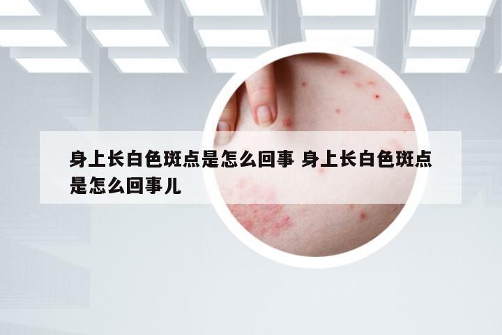 身上长白色斑点是怎么回事 身上长白色斑点是怎么回事儿