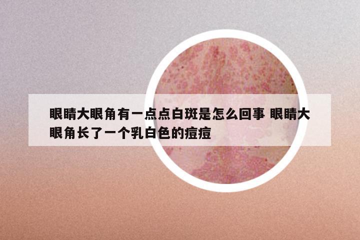 眼睛大眼角有一点点白斑是怎么回事 眼睛大眼角长了一个乳白色的痘痘