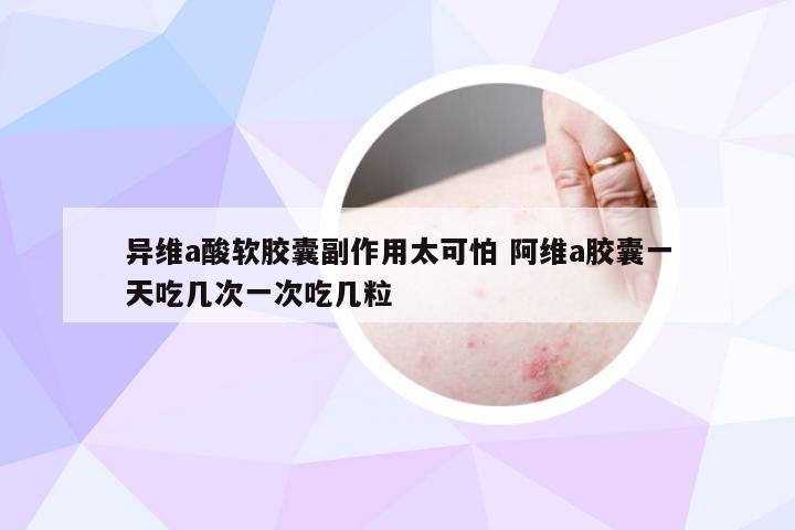 异维a酸软胶囊副作用太可怕 阿维a胶囊一天吃几次一次吃几粒