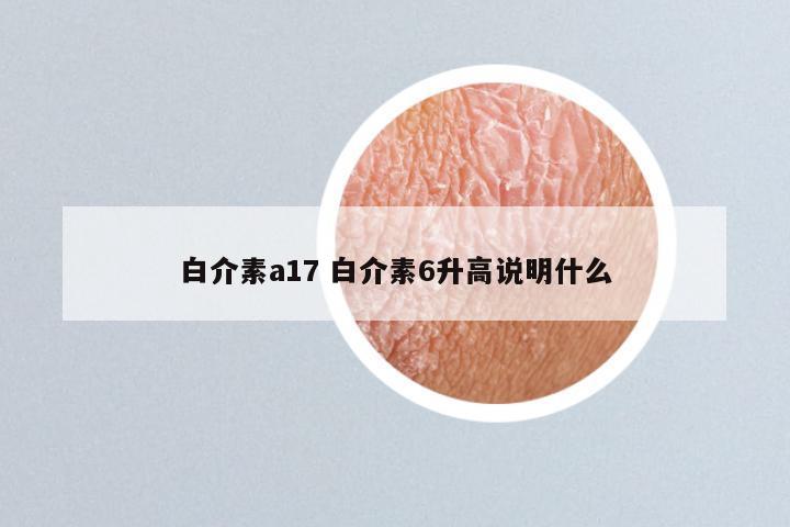 白介素a17 白介素6升高说明什么