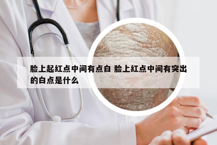 脸上起红点中间有点白 脸上红点中间有突出的白点是什么