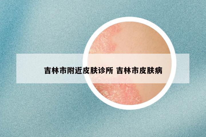 吉林市附近皮肤诊所 吉林市皮肤病
