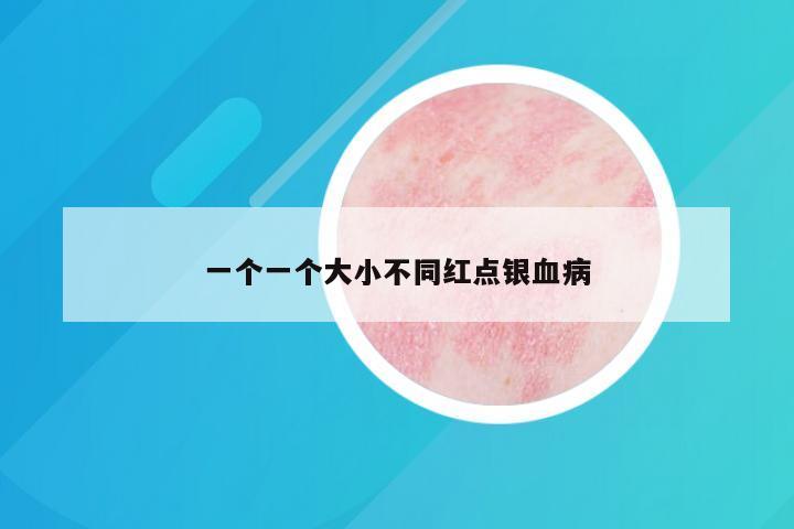 一个一个大小不同红点银血病