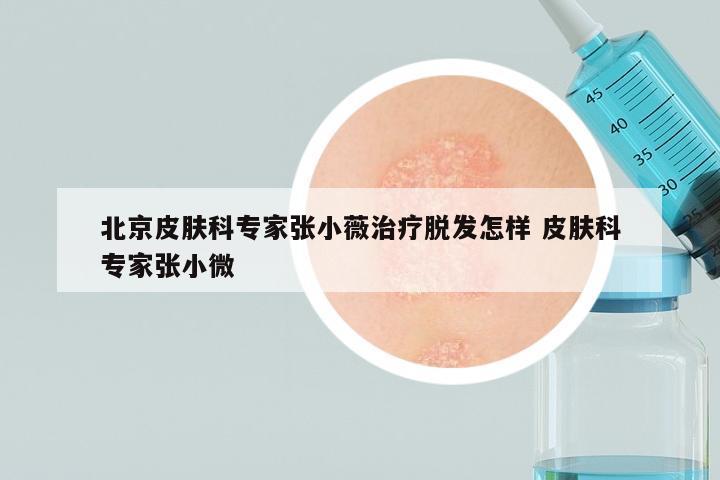 北京皮肤科专家张小薇治疗脱发怎样 皮肤科专家张小微
