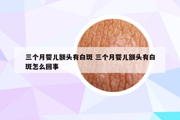 三个月婴儿额头有白斑 三个月婴儿额头有白斑怎么回事
