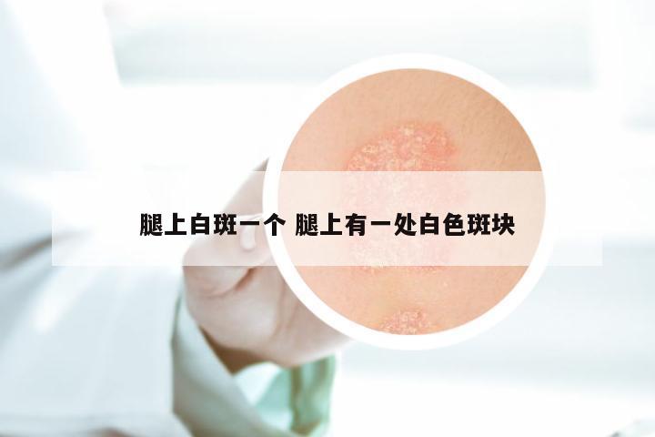 腿上白斑一个 腿上有一处白色斑块