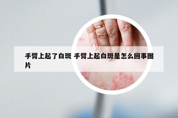 手臂上起了白斑 手臂上起白斑是怎么回事图片