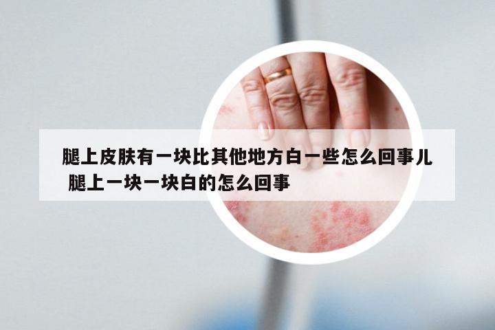 腿上皮肤有一块比其他地方白一些怎么回事儿 腿上一块一块白的怎么回事