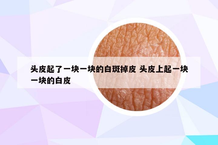 头皮起了一块一块的白斑掉皮 头皮上起一块一块的白皮