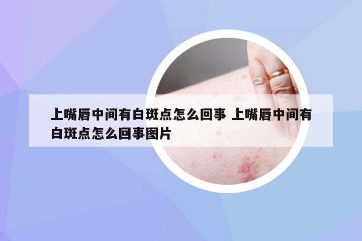 上嘴唇中间有白斑点怎么回事 上嘴唇中间有白斑点怎么回事图片