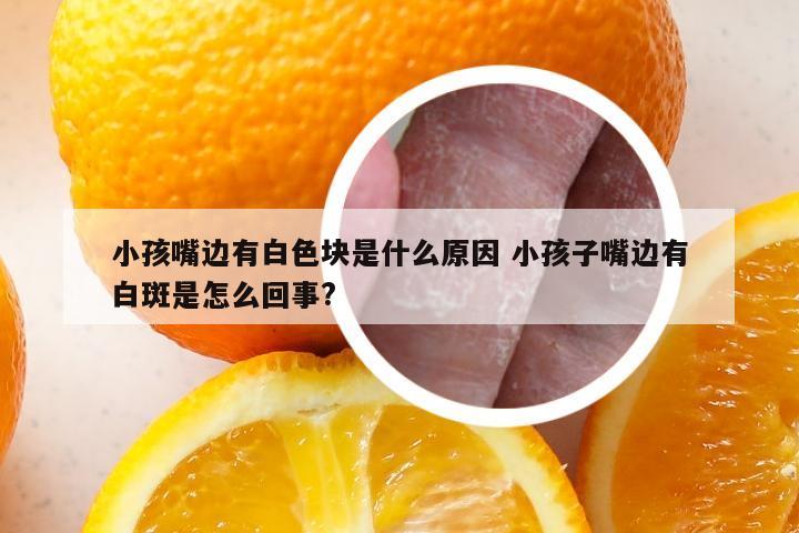 小孩嘴边有白色块是什么原因 小孩子嘴边有白斑是怎么回事?