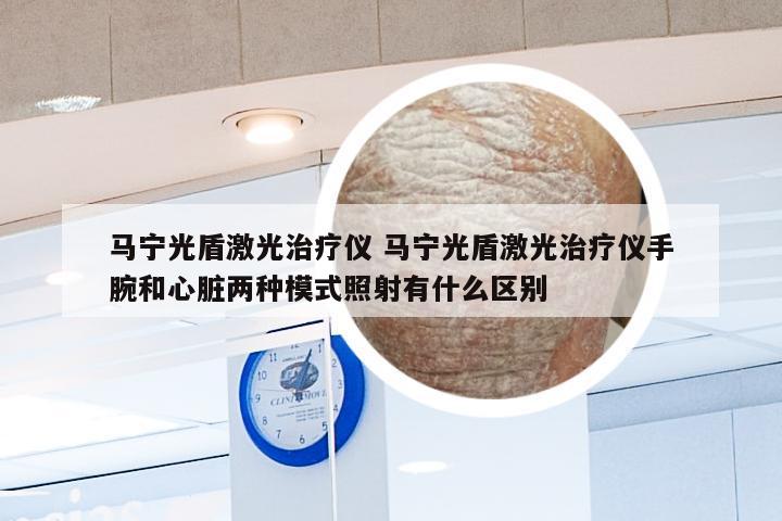 马宁光盾激光治疗仪 马宁光盾激光治疗仪手腕和心脏两种模式照射有什么区别