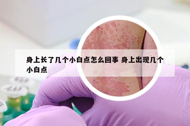 身上长了几个小白点怎么回事 身上出现几个小白点
